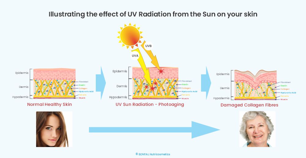 Effect of UV radiation on your skin